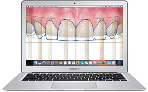 digital-smile-1